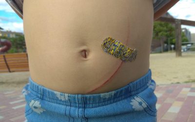 La denuncia de Ganar Alcorcón sobre el accidente de una niña en un juego infantil consigue que el Partido Popular lo arregle