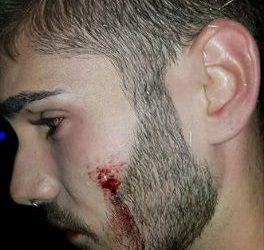 Ganar Alcorcón denuncia la inoperatividad de la oficina municipal contra los delitos de odio ante la agresión homófoba frente a la discoteca Jowke.